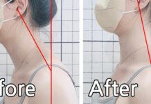 거북목과 일자목의 차이