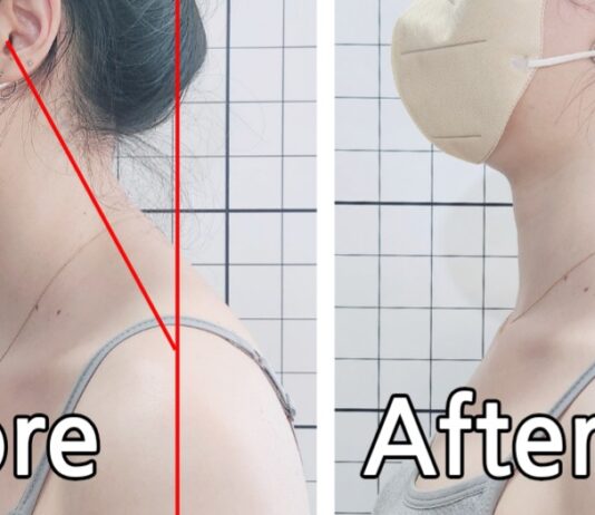 거북목과 일자목의 차이