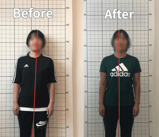 몸이 한쪽으로 기우는 느낌이 든다면?