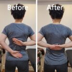 오십견, 방치하면 일상생활도 어려워져