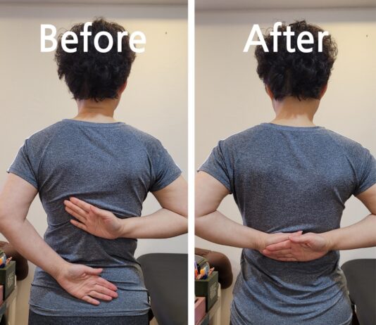 오십견, 방치하면 일상생활도 어려워져