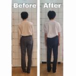 공부하는 아이들, 척추 측만 많아지고 있어