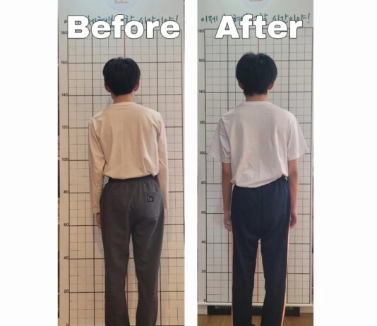 공부하는 아이들, 척추 측만 많아지고 있어