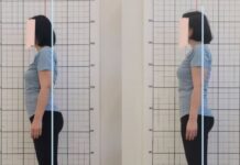 열린 가위 증후군을 아시나요?