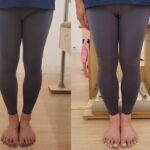 이제 필라테스, 오다리 교정 사례 공개