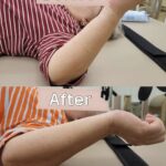 이제 필라테스, 오십견 재활 운동 사례